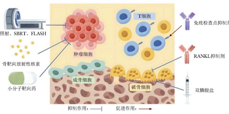 肿瘤骨转移怎么办?一文详解放疗、免疫及靶向治疗最新进展