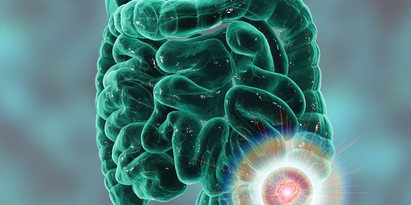 Haystack MRD检测获FDA突破性认定:结直肠癌、食管癌等实体瘤早期复发监测新突破