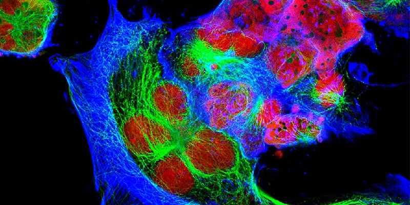GD2-CART01 CAR T细胞疗法：儿童神经母细胞瘤患者的长期生存新希望