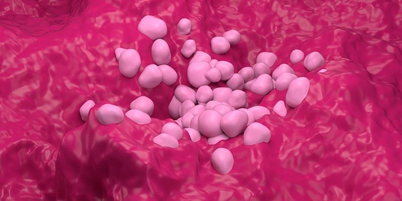 Ivonescimab在EGFR突变非小细胞肺癌中展现突破性疗效:HARMONi临床研究揭示PFS显著改善