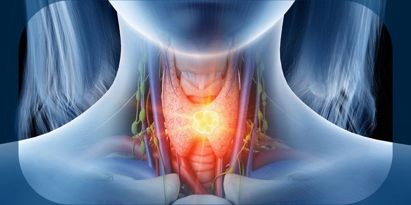 Ozuriftamab Vedotin治疗口咽鳞状细胞癌：FDA加速审批路径与临床疗效揭秘