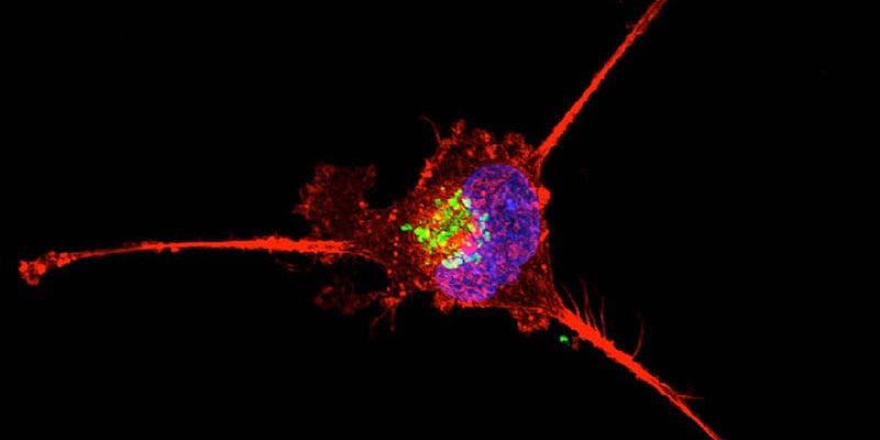 依维莫司联合卡铂：晚期三阴性乳腺癌治疗的II期临床研究进展