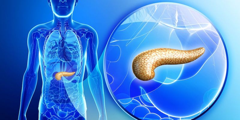 Telisotuzumab Adizutecan治疗胰腺癌:1期研究显示客观缓解率达23.8%