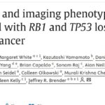 前列腺癌诊疗新发现：RB1/TP53基因缺失如何重塑肿瘤代谢？