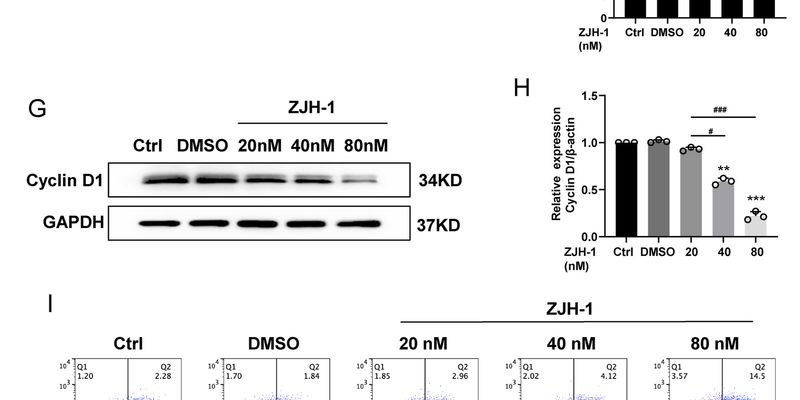 ZJH-1研究新进展:精准靶向HDAC1,为去势抵抗性前列腺癌治疗带来新希望