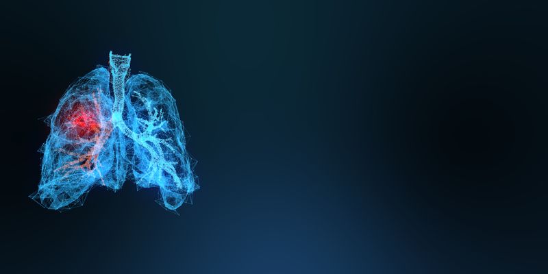 阿替利珠单抗改善小细胞肺癌生活质量:NRG LU005试验最新数据解读