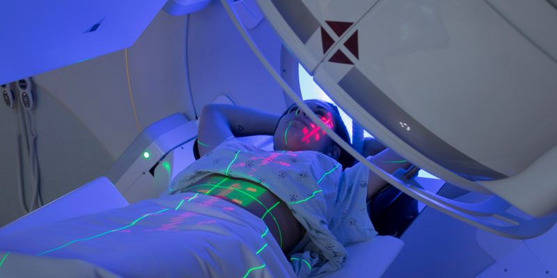 脉冲式低剂量率放化疗:显著降低食管癌与肺癌治疗中的严重食管炎副作用