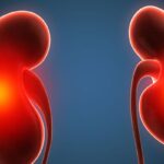 肾细胞癌术后治疗新突破：帕博利珠单抗联合贝尔舒凡显著改善无病生存期