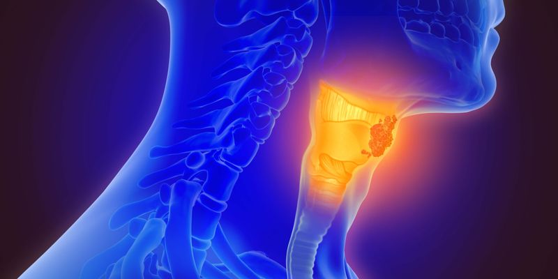 头颈癌治疗新里程碑:帕博利珠单抗(可瑞达)新辅助疗法在欧盟获批