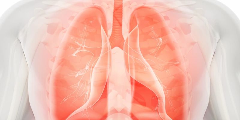 Tarlatamab显著延长小细胞肺癌生存期！DeLLphi-304研究奠定二线治疗新标准