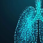 Zocilurtatug Pelitecan：小细胞肺癌（SCLC）新药，脑转移患者缓解率高达66%！