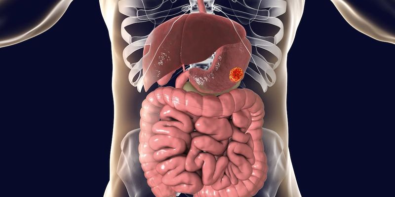 胃癌一线治疗新希望:Domvanalimab联合方案2期研究中位生存期达26.7个月