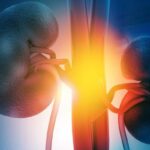 晚期肾细胞癌新突破：贝尔舒法联合仑伐替尼疗法显著延长无进展生存期