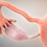 JSKN003获FDA快速通道资格：治疗铂耐药卵巢癌客观缓解率达63%！