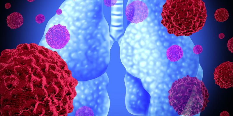 替雷利珠单抗一线治疗小细胞肺癌:RATIONALE-312研究揭示长期生存获益