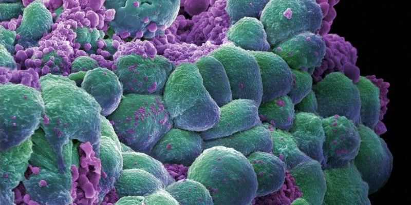 德曲妥珠单抗联合帕妥珠单抗：HER2阳性乳腺癌一线治疗新突破，日本提交上市申请