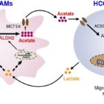 揭秘肝癌转移新机制：靶向肿瘤“帮凶”或成抑制扩散新策略