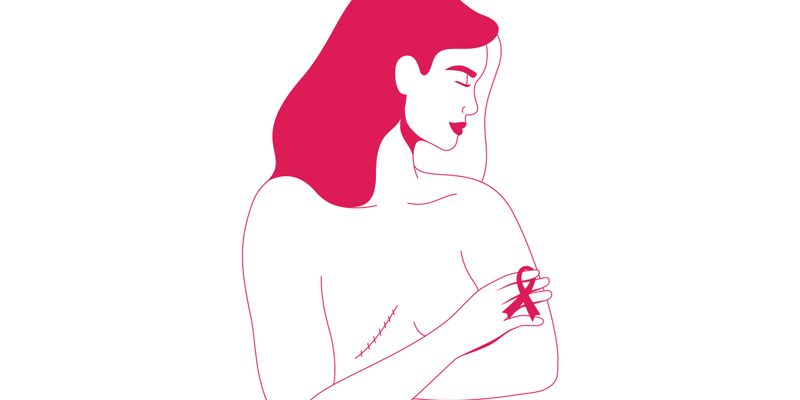最新研究:乳房切除术对乳腺癌患者的性健康与心理影响不容忽视