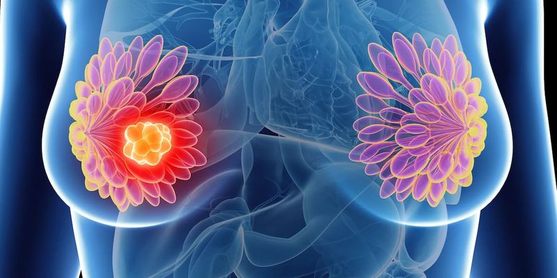 三阴性乳腺癌治疗新突破:ADC药物戈沙妥珠单抗等的疗效与用药顺序解析