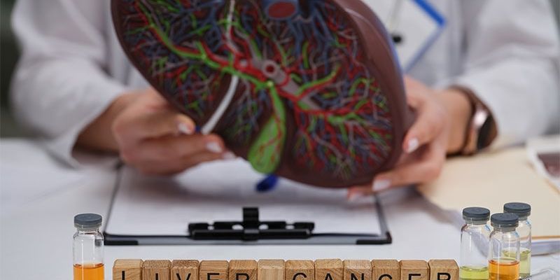 肝癌防治新策略:欧洲指南强调风险分层筛查对提高肝细胞癌治愈率的重要性