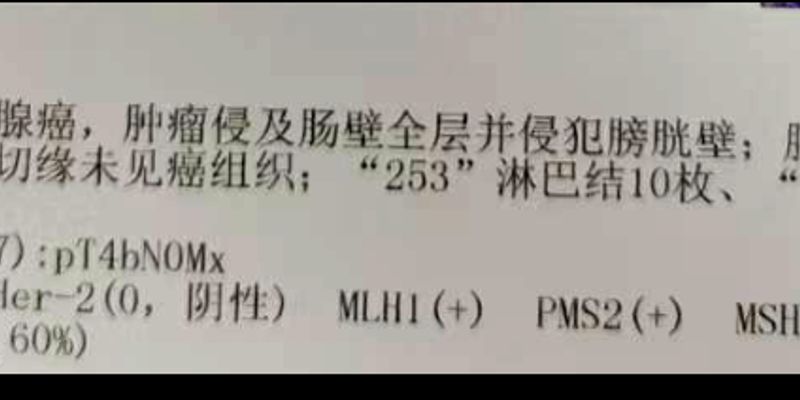 结肠癌KRAS G12C突变靶向治疗新突破：阿达格拉西布与索托雷塞联合方案深度解析