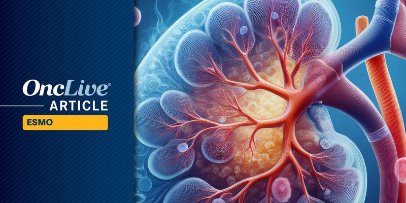 ESMO 2025泌尿肿瘤前沿：膀胱癌、肾癌、前列腺癌靶向治疗新突破