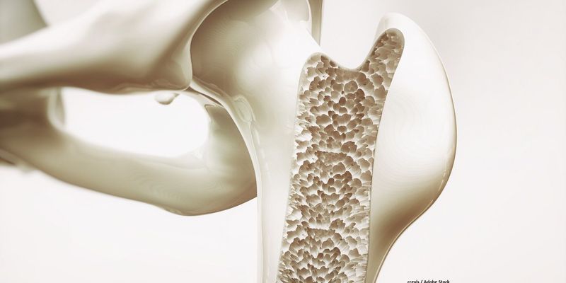 地舒单抗生物类似药获FDA“可互换”认证，治疗骨质疏松与癌症骨转移添新选择