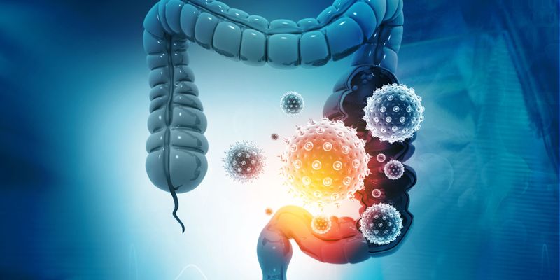 Ezabenlimab联合化疗治疗肛门鳞状细胞癌：II期研究显示客观缓解率达93%