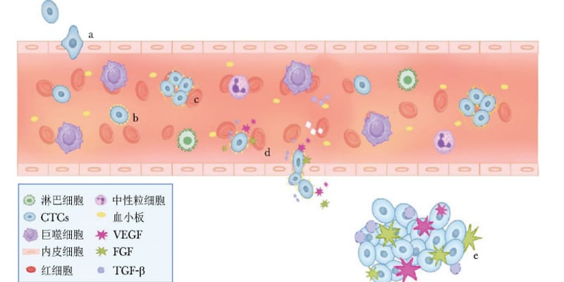 警惕“滴血传癌”！循环肿瘤细胞（CTCs）与输血安全性的深度剖析