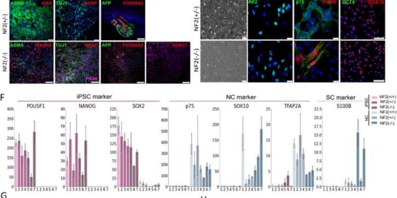 攻克神经纤维瘤病2型（NF2）：创新3D模型为神经鞘瘤靶向药研发带来新希望