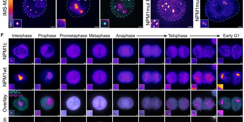 白血病治疗新靶点！科学家发现通用“死穴”C-body，有望攻克耐药难题