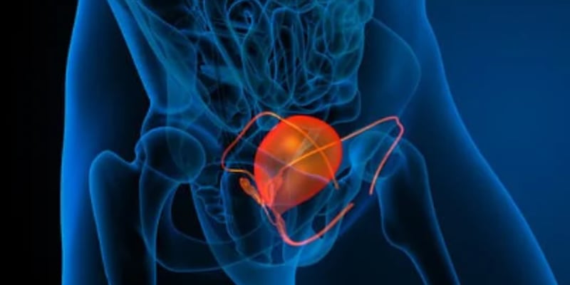 寡复发前列腺癌新希望：177Lu-PNT2002联合放疗将无进展生存期延长超10个月