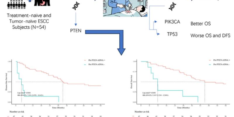 食管鳞癌预后新突破：ctDNA检测揭示PTEN/TP53/PIK3CA突变对生存期的关键影响