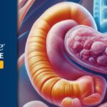 ESMO 2025：度伐利尤单抗等新药在胃癌与胰腺癌治疗中的突破性进展