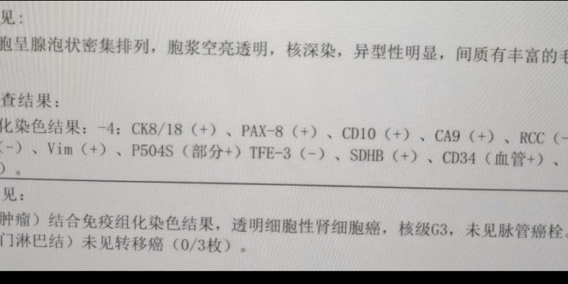 双侧肾癌竟是遗传?PALB2基因突变揭示治疗新方向,奥拉帕利或成新选择