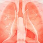 Lifileucel治疗晚期非小细胞肺癌显奇效：IOV-LUN-202研究揭示持久缓解