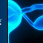 米维妥昔单抗获批：FRα阳性铂耐药卵巢癌治疗迎来新突破