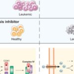 急性髓系白血病（AML）新疗法突破：靶向血红素，诱导“铜死亡”机制消灭耐药细胞