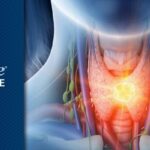 头颈癌术后复发预警：淋巴液ctDNA检测灵敏度远超传统病理分析