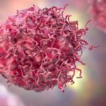 皮肤T细胞淋巴瘤预后新指标：研究发现TCR克隆型Vb20和Vg8与不良预后相关