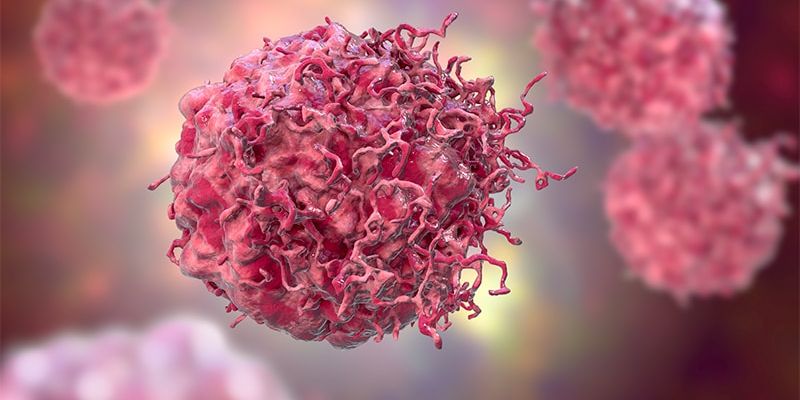 皮肤T细胞淋巴瘤预后新指标：研究发现TCR克隆型Vb20和Vg8与不良预后相关