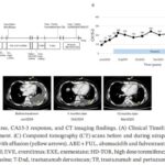 尼拉帕利治疗PALB2突变乳腺癌案例：从显著疗效到耐药，回复突变是关键