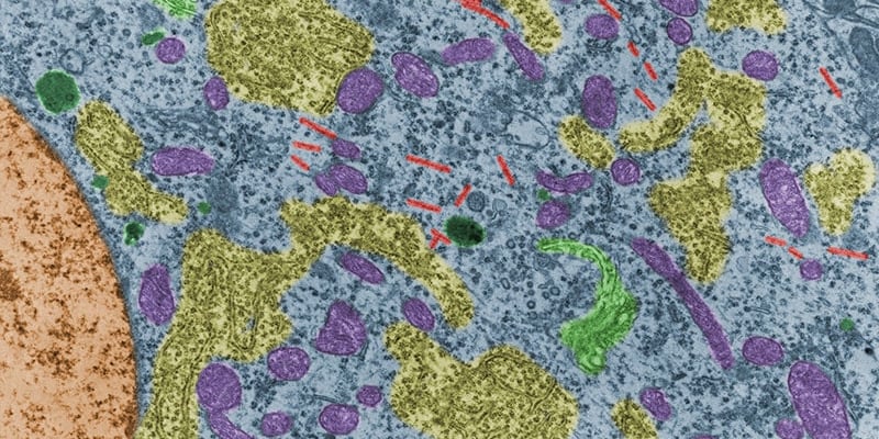 Carba1：化疗神经痛的终结者？新研究揭示预防紫杉醇副作用的希望