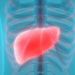 肝癌免疫治疗新突破：联合根治性手术可显著延长患者生存期