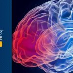 依氟鸟氨酸联合洛莫司汀：显著延长IDH突变星形细胞瘤患者生存期