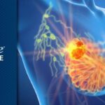 依沃西单抗获突破性疗法认定，三阴性乳腺癌一线治疗迎来新希望