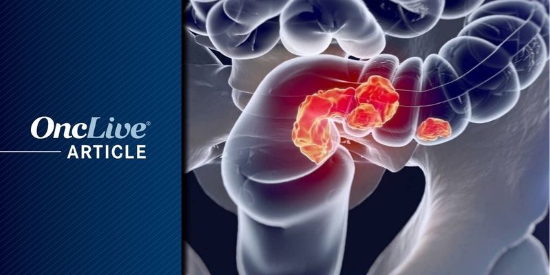 AMB-05X二期临床研究：靶向CSF1R，攻克ctDNA阳性结直肠癌复发难题