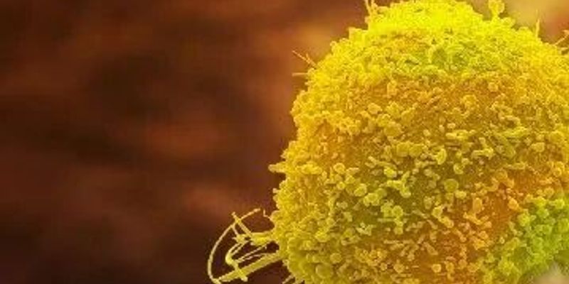 NK细胞疗法全解析：揭秘人体第一道抗癌防线如何对抗肿瘤