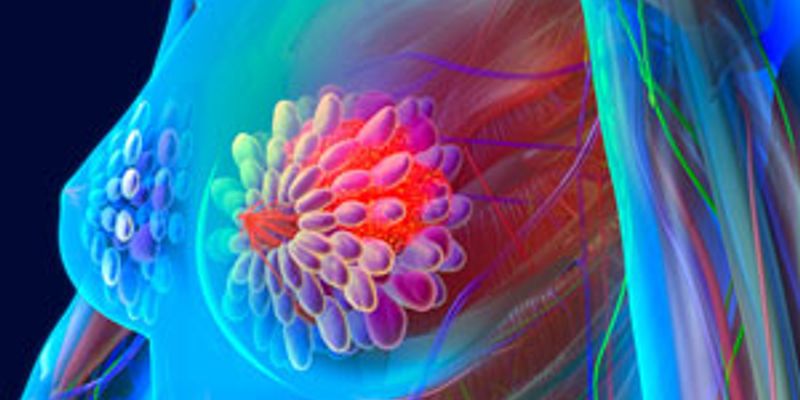 并非所有避孕药都一样！最新研究揭示：部分激素成分或显著增加乳腺癌风险