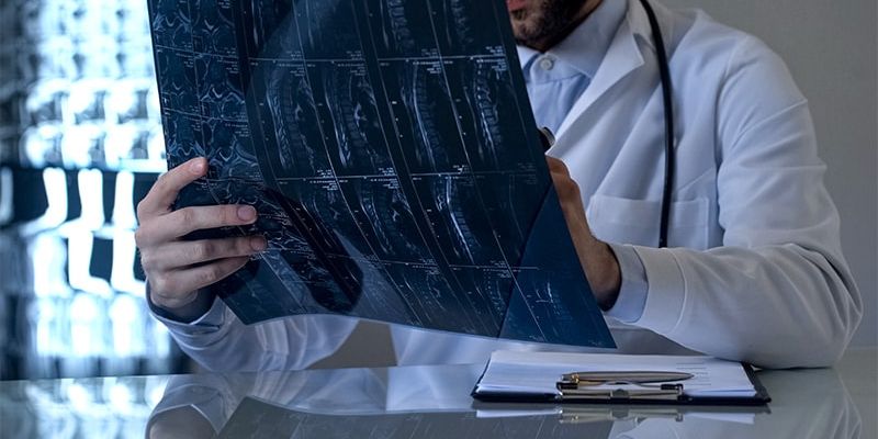 不只是瘫痪：创伤性脊髓损伤如何悄然增加中风、痴呆和心脏病风险？